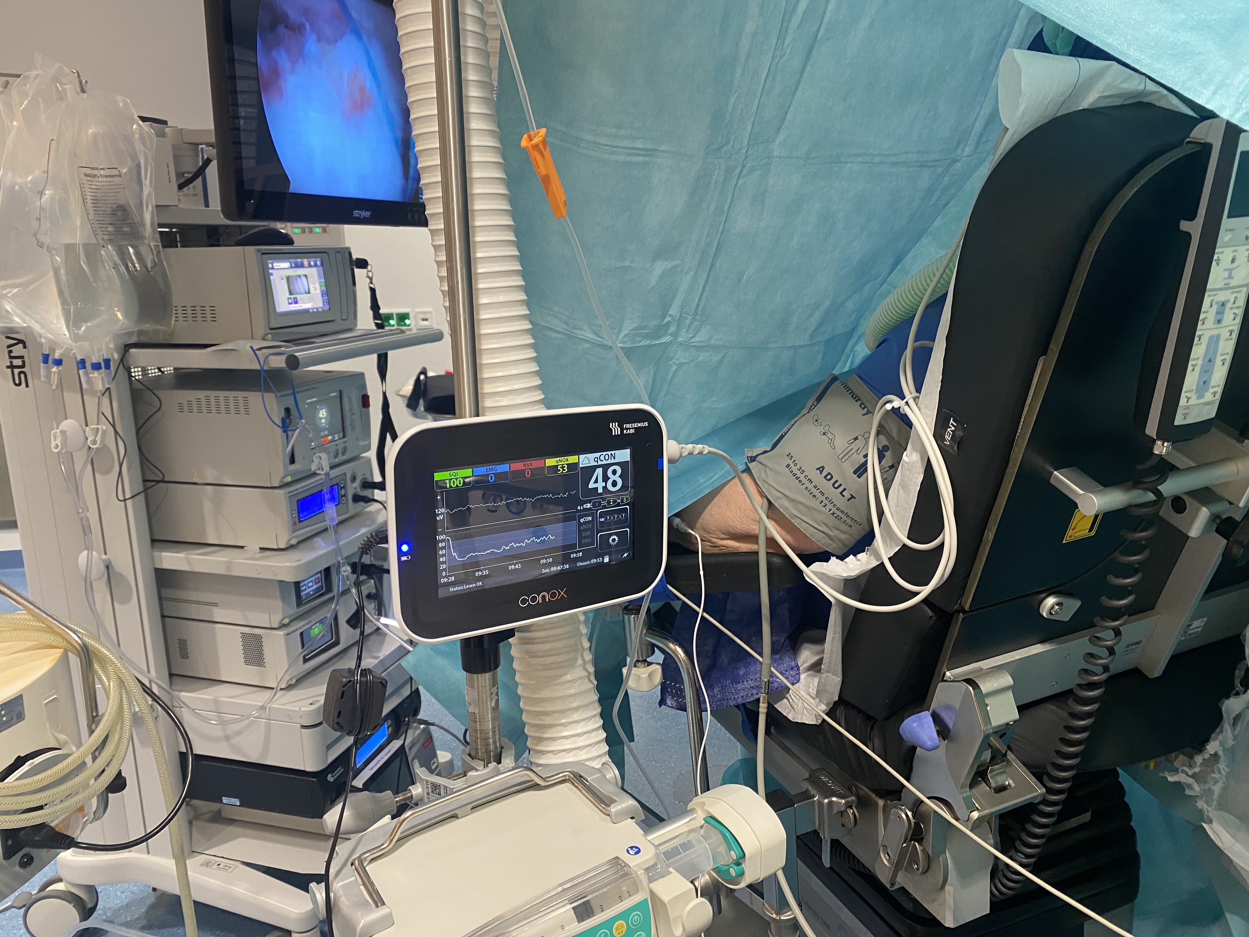 Conox BIS Monitor